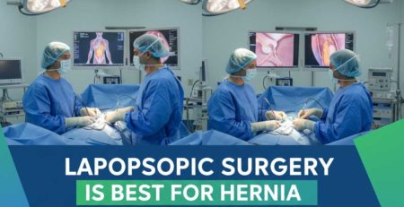 Why Laparoscopic Surgery is Best for Hernia and Piles Treatment